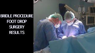 Bridle Procedure. Foot Drop Surgery. Surgical technique and Results. (Dr.Arian Celaj)