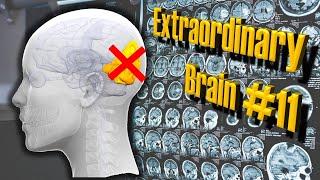 The Brain That Was Cortically Blind But Could Still See | Extraordinary Brains #11