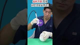 실제 윤곽 수술 장면 대공개!!!