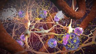 Random42 Science In Motion - Macrophages in Traumatic Brain Injury