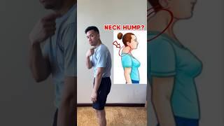 Learn how to fix NECK HUMP at home!!  #kyphosis #neckhump