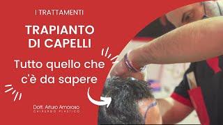 Trapianto di Capelli Tutto Quello Che Devi Sapere - Dott. Arturo Amoroso