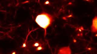 Living Mouse Brain Captured using FVMPE-RS and TruResolution Objectives