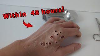 My Trypophobia hand Revealed | What’s Inside? | ASMR Exploration