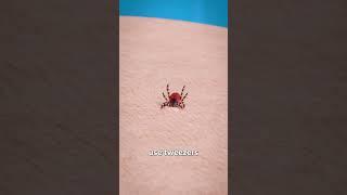 How To Remove A Tick 