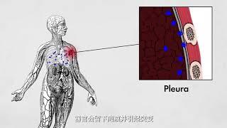 一座矿井的失误，导致该小镇被致命的蓝色尘埃包围 # 涨知识 # 科普一下 # 蓝色石棉 # 石棉# 科普 # 切尔诺贝利