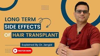 Long-term side effects of Hair Transplant | Best Hair Transplant Surgeon - Dr. Jangid | Delhi