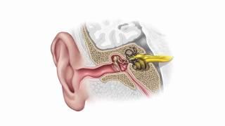 Як ми чуємо? Про слух, втрату слуху і слухові апарати