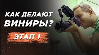 ВИНИРЫ. Этап 1. Фото и видео документация. Виниры для зубов