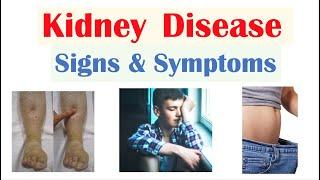 Kidney (Renal) Disease Signs & Symptoms (ex. Peripheral Edema, Fatigue, Itchiness)