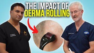 Derma Rolling: Impact On Topical Therapies | The Hair Loss Show