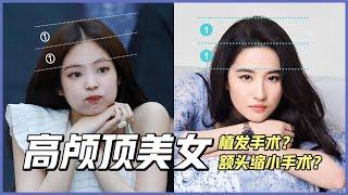 【韩国整形】能打造“高颅顶美女”的“额头缩小术”到底是什么？会有副作用吗？行业科普！（feat:李朴频道）