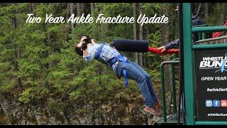 2 Year Ankle Break Update  | Whistler Mountain Biking & Bungee Jump