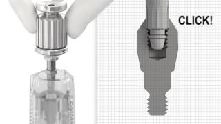 UniAbutment EV - Installation | Dentsply Sirona