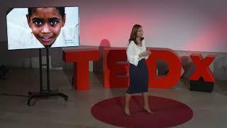 How to de-dramatize failure and turn it into success? | Mylène Thiébaud | TEDxHWZ