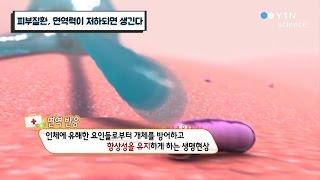 피부질환, 면역력이 저하되면 생긴다? / YTN 사이언스