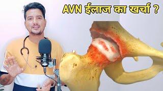 AVN Treatment Cost | इससे कम कहीं नही | AVN Treatment cost Correct information | Dr.Amit Bharti |