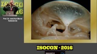 Prof. Huttenbrink & Dr. Robert Vincent's Lecture @ ISOCON, 2016