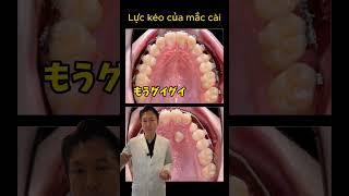 こんな歯並びの方は是非#歯並び #歯医者 #蒲田 #矯正 #歯茎