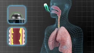 How AirPhysio Works In The Lungs