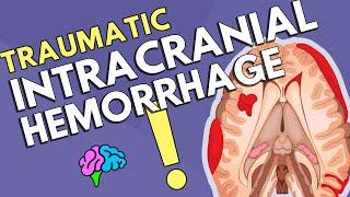 Intracranial Hemorrhage