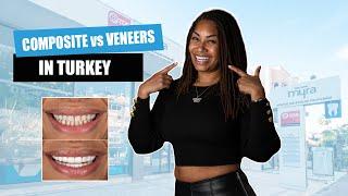 Composite Veneers vs Laminate Veneers in Turkey 2021| Myra Dental Centre Turkey