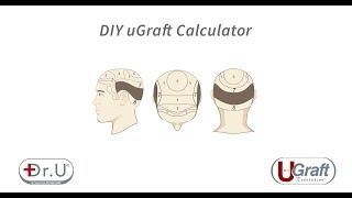 DIY uGraft Calculator Tutorial: How to Find Your Graft Count for Hair Transplant