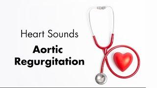 Aortic Regurgitation  - Heart Sounds - MEDZCOOL