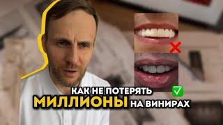 Керамические VS композитные виниры: Что выбрать? Мнение стоматолога