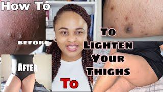 How To Lighten Dark Inner Thighs Fast and Effective, Naturally.