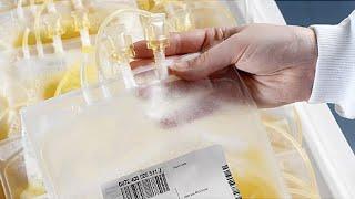 Plasmapheresis in Acute Central Nervous System Inflammation