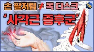 손, 팔 저림 증상 | 목 디스크가 아닌 '사각근 증후군'을 의심해라! | 중사각근 신경 이완법 | 스트레칭법