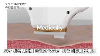 다양한 잡티를 한번에 없애고 싶다면? #슈퍼벨로체