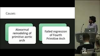 Double Aortic Arch and Arterial Access for Neurovascular Intervention - Mayank Patel, MD