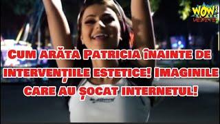 Cum arăta Patricia înainte de intervențiile estetice! Imaginile care au șocat internetul!