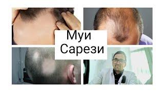 Сабабхои рехтани муи сар. Причины выпадения волос.