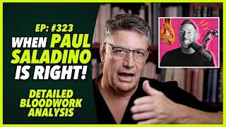 Ep:323 WHEN PAUL SALADINO IS RIGHT! Detailed bloodwork analysis - by Dr. Robert Cywes M.D. PhD