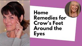 Home Remedies for Crow's Feet Around the Eyes