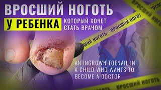 An ingrown toenail in a teenager. Child's reaction to removal!