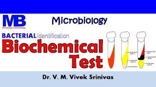 BIOCHEMICAL TEST | Bacterial Identification Technique | Microbiology | Vivek Srinivas |#Bacteriology