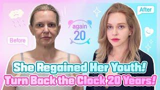 Watch How She Regains Her Youth with Amazing Results from DA Plastic Surgery Lifting!