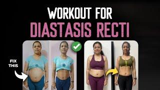 5 Best Exercises for DIASTASIS RECTI (Follow Along) | Heal Ab Separation