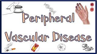 Peripheral Vascular Disease(PVD): Causes, Signs & Symptoms, Diagnosis &Treatment