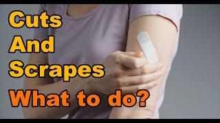 Cuts and Scrapes, What to do? First aid and how to treat cuts, scrapes and scratches. Wound Care.