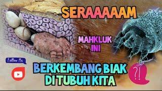 SERAAAAM || MAHKLUK ANEH HIDUP DITUBUH MANUSIA