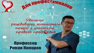 Удаление рецидивного метастаза  печени с участком правого предсердия.