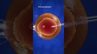 How Invitro Fertilization (IVF) works  #shorts