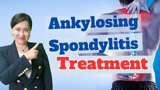 Ankylosing Spondylitis Treatment: What They Don't Tell You