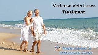 Varicose Vein Treatment with Laser by Dr  Julian Javier