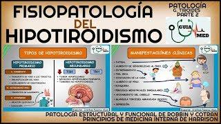 HIPOTIROIDISMO FISIOPATOLOGÍA | GuiaMed